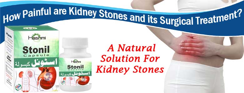 Kidney Stones Treatment