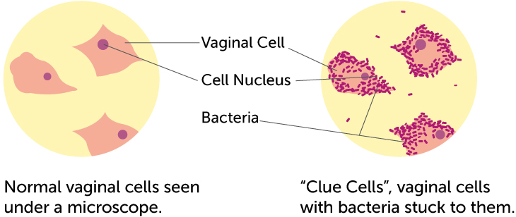 clue-cells