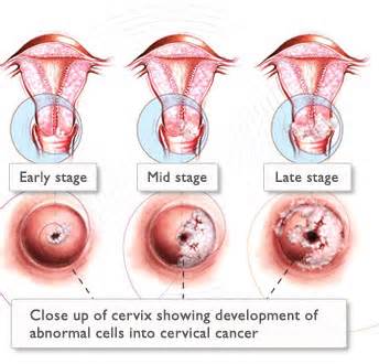 hpv